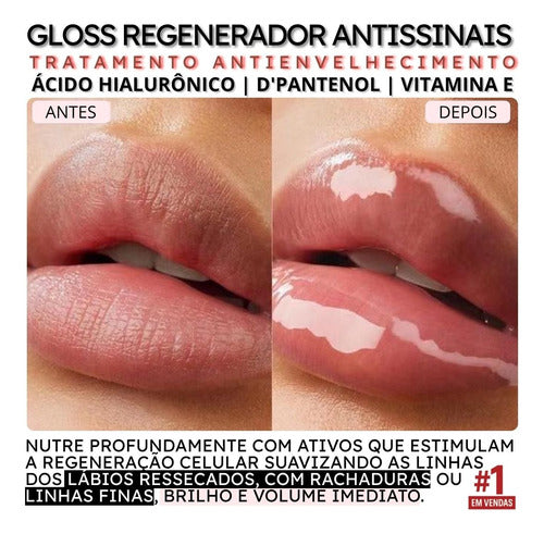 Kit 2und Volume Gloss Glitter Aumenta Boca Lábios Big Mouth