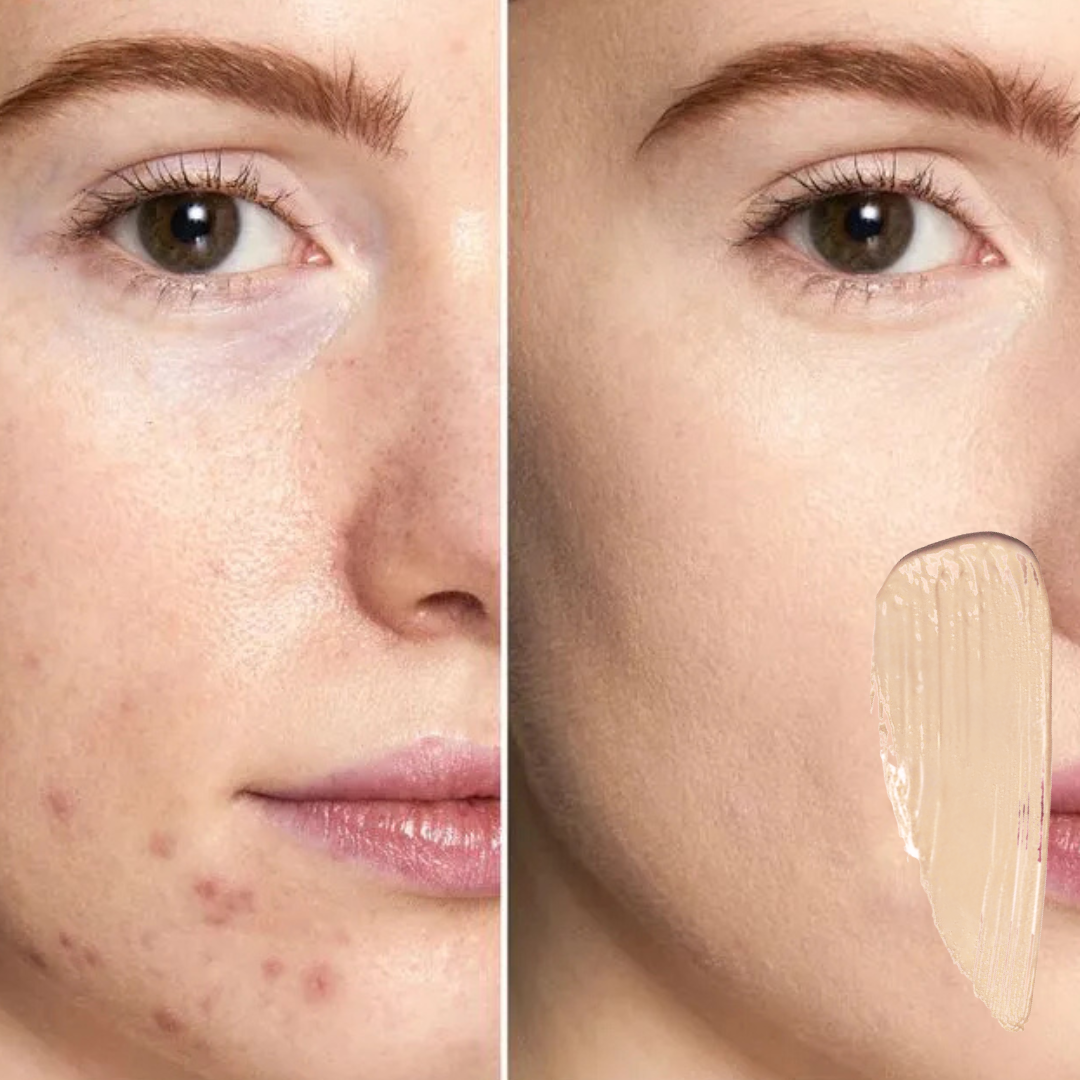 Corretivo de Alta Cobertura Phoera