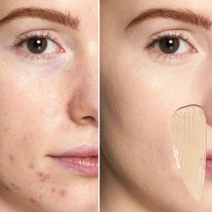 Corretivo de Alta Cobertura Phoera