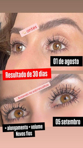 Kit 2un Sérum Crescimento Cílios Sobrancelhas Biotina Phoera