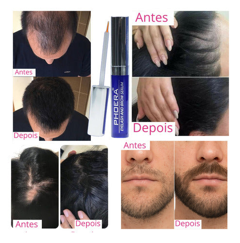 Sérum Tratamento Crescimento Cílios Sobrancelhas Phoera