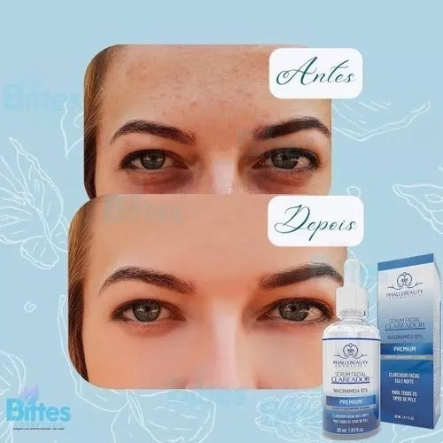 Sérum Clareador Premium Niacinamida10% Skincare Phállebeauty Momento De Aplicação Dia/noite Tipo De Pele Todo Tipo De Pe